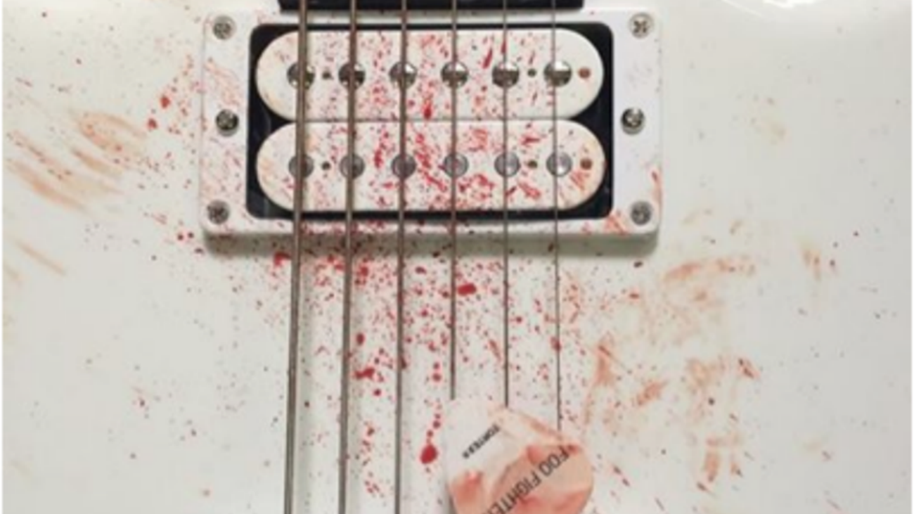 Blodstänkta livstecken från Foo Fighters
